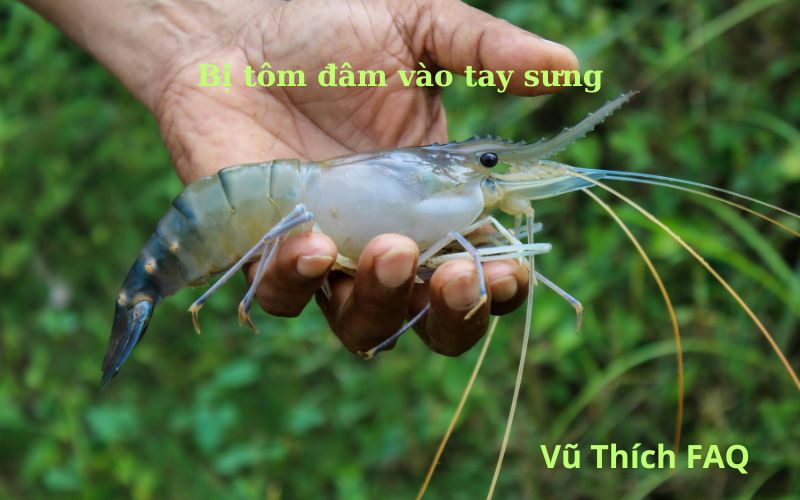 Bị tôm đâm vào tay sưng có sao không? Cách xử lý đúng và hiệu quả