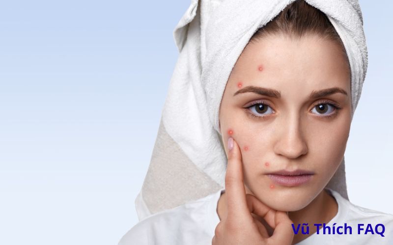 Miếng dán mụn dán trong bao lâu? có nên dán qua đêm?